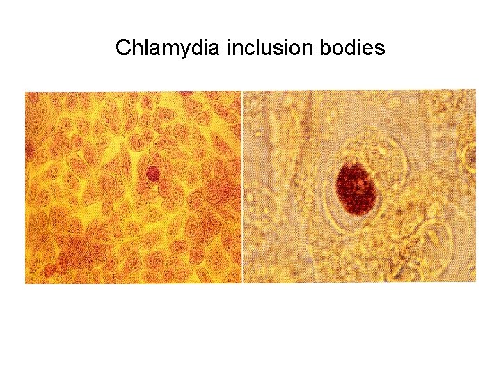 Chlamydia inclusion bodies 