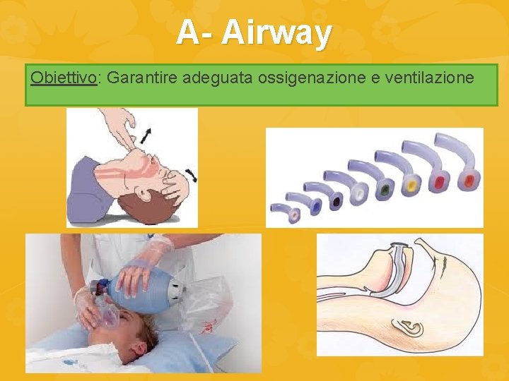 A- Airway Obiettivo: Garantire adeguata ossigenazione e ventilazione 