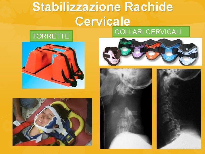 Stabilizzazione Rachide Cervicale TORRETTE COLLARI CERVICALI 