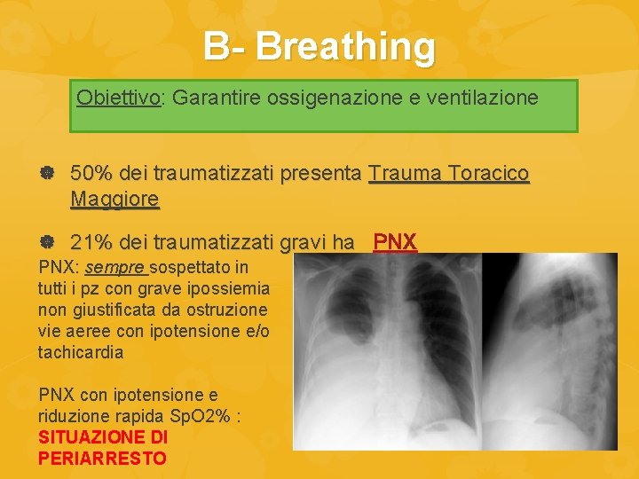 B- Breathing Obiettivo: Garantire ossigenazione e ventilazione 50% dei traumatizzati presenta Trauma Toracico Maggiore