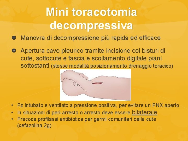 Mini toracotomia decompressiva Manovra di decompressione più rapida ed efficace Apertura cavo pleurico tramite