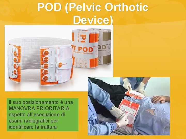 POD (Pelvic Orthotic Device) Il suo posizionamento è una MANOVRA PRIORITARIA rispetto all’esecuzione di