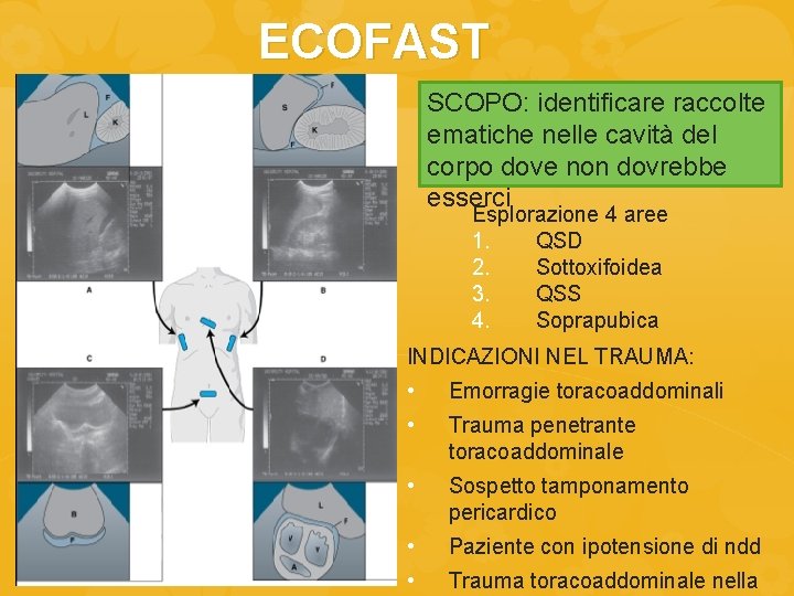 ECOFAST SCOPO: identificare raccolte ematiche nelle cavità del corpo dove non dovrebbe esserci Esplorazione