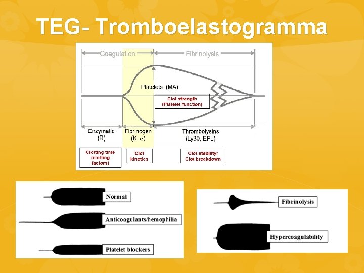 TEG- Tromboelastogramma 