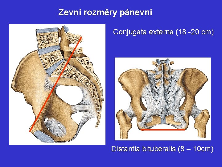 Zevní rozměry pánevní Conjugata externa (18 -20 cm) Distantia bituberalis (8 – 10 cm)