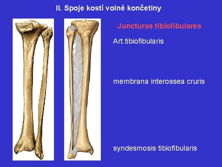 II. Spoje kostí volné končetiny Juncturae tibiofibulares Art. tibiofibularis membrana interossea cruris syndesmosis tibiofibularis