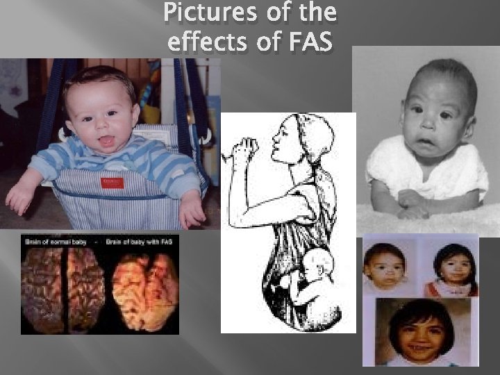 Pictures of the effects of FAS 