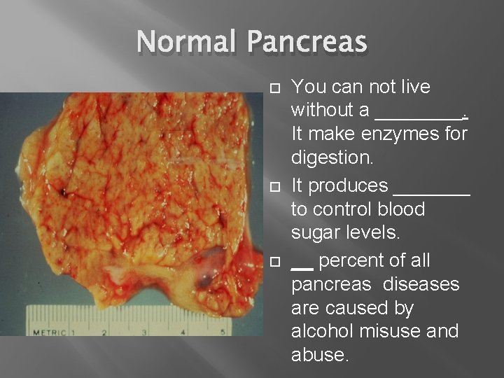 Normal Pancreas You can not live without a ____. It make enzymes for digestion.