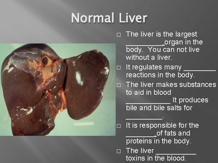 Normal Liver � � � The liver is the largest _____ organ in the