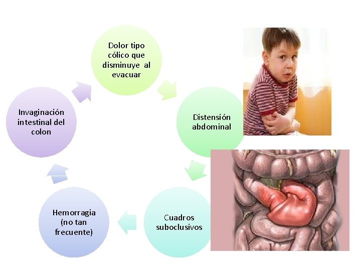 Dolor tipo cólico que disminuye al evacuar Invaginación intestinal del colon Hemorragia (no tan Dolor tipo cólico que disminuye al evacuar Invaginación intestinal del colon Hemorragia (no tan