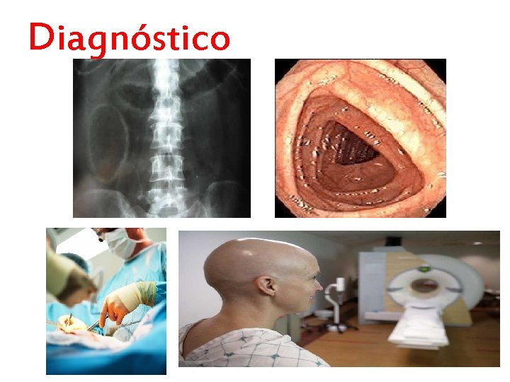 Diagnóstico Diagnóstico
