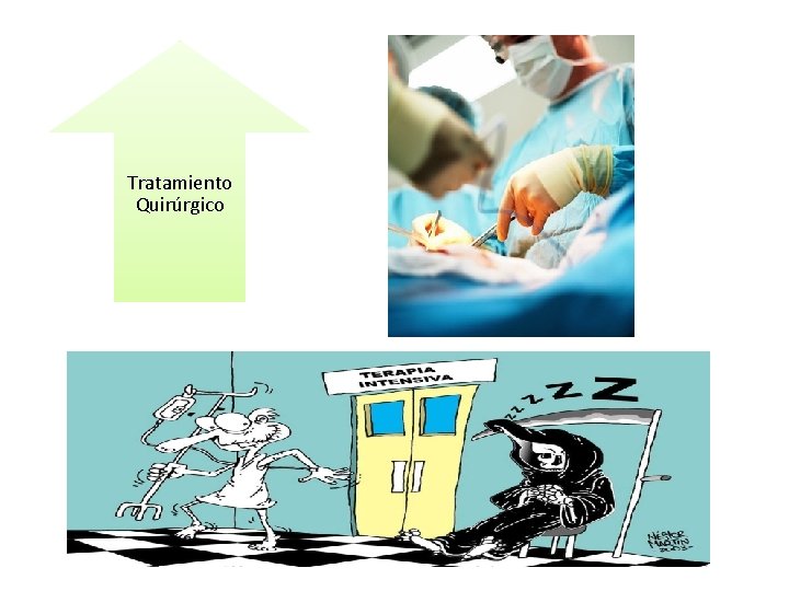 Tratamiento Quirúrgico Tratamiento Quirúrgico