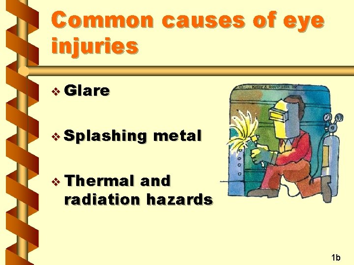 Common causes of eye injuries v Glare v Splashing metal v Thermal and radiation