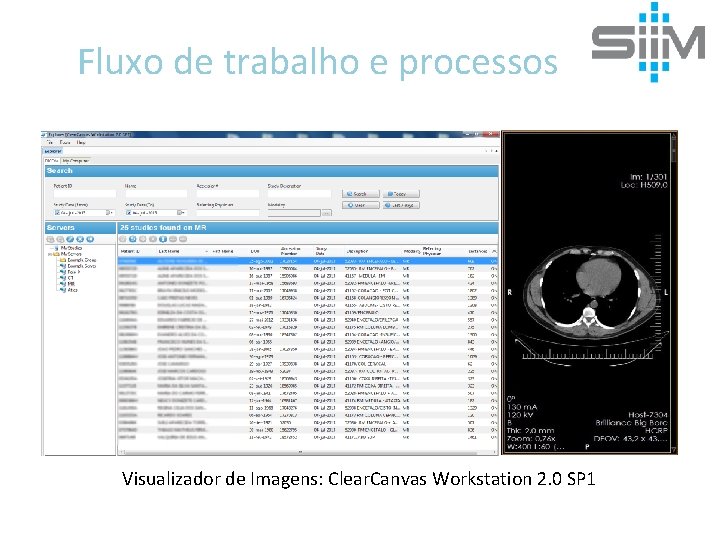 Fluxo de trabalho e processos Visualizador de Imagens: Clear. Canvas Workstation 2. 0 SP