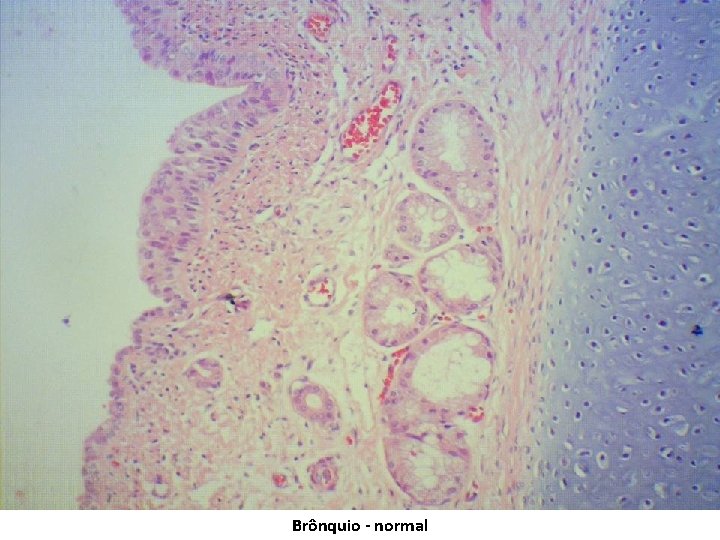 Brônquio - normal 