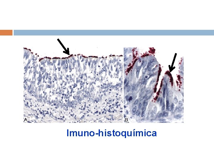 Imuno-histoquímica 