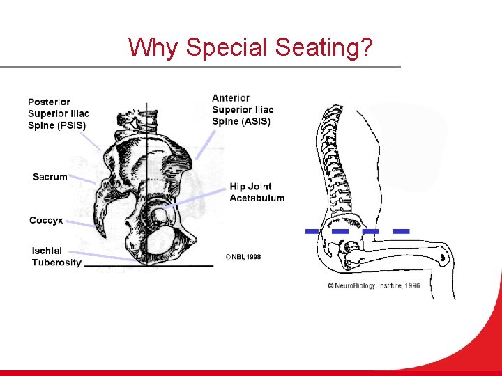 Why Special Seating? 