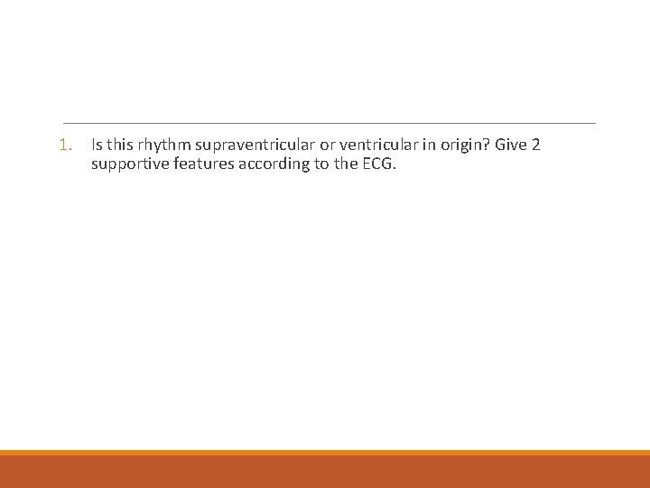 1. Is this rhythm supraventricular or ventricular in origin? Give 2 supportive features according
