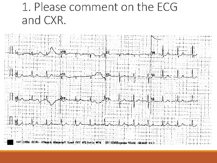 1. Please comment on the ECG and CXR. 