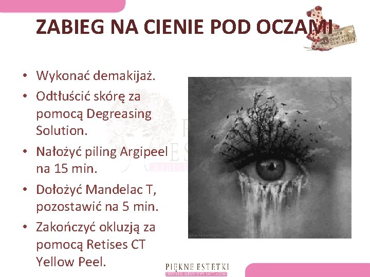 ZABIEG NA CIENIE POD OCZAMI • Wykonać demakijaż. • Odtłuścić skórę za pomocą Degreasing