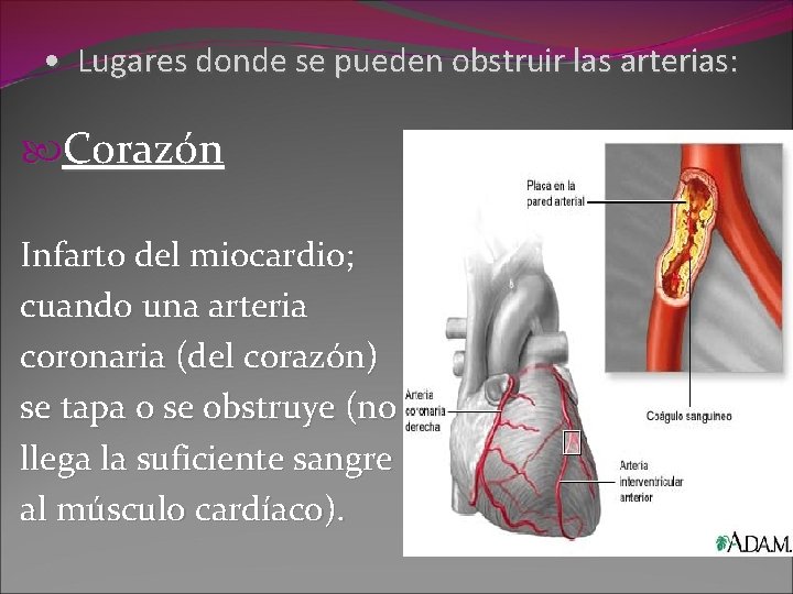  • Lugares donde se pueden obstruir las arterias: Corazón Infarto del miocardio; cuando