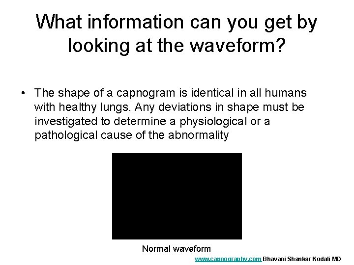 What information can you get by looking at the waveform? • The shape of