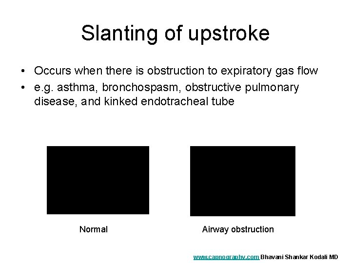 Slanting of upstroke • Occurs when there is obstruction to expiratory gas flow •