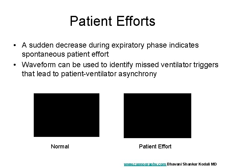 Patient Efforts • A sudden decrease during expiratory phase indicates spontaneous patient effort •