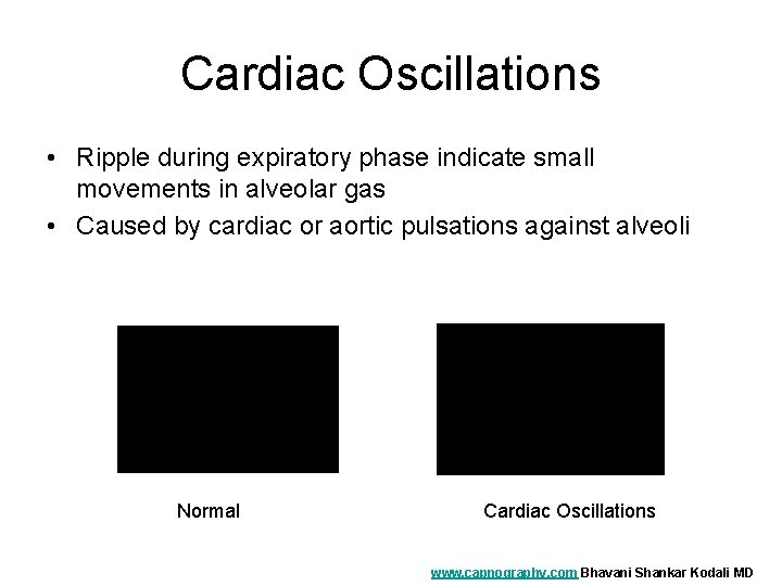 Cardiac Oscillations • Ripple during expiratory phase indicate small movements in alveolar gas •