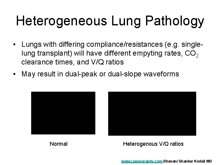 Heterogeneous Lung Pathology • Lungs with differing compliance/resistances (e. g. singlelung transplant) will have