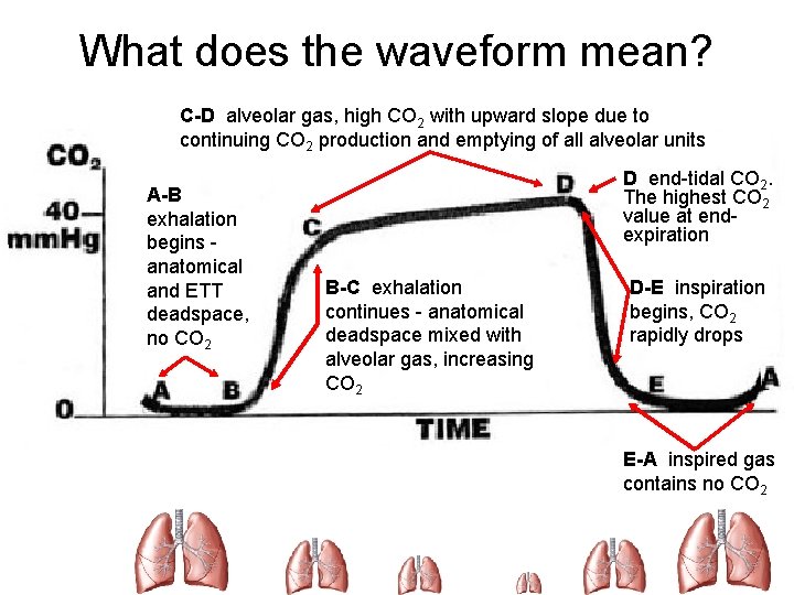 What does the waveform mean? C-D alveolar gas, high CO 2 with upward slope