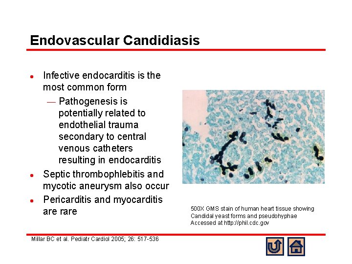 Endovascular Candidiasis l l l Infective endocarditis is the most common form ¾ Pathogenesis