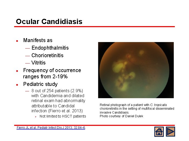 Ocular Candidiasis l l l Manifests as ¾ Endophthalmitis ¾ Chorioretinitis ¾ Vitritis Frequency