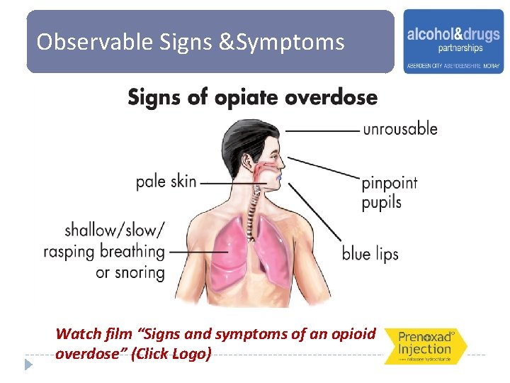 Observable Signs &Symptoms Watch film “Signs and symptoms of an opioid overdose” (Click Logo)