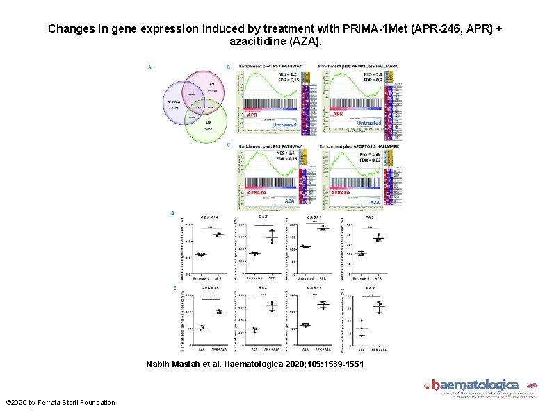 Changes in gene expression induced by treatment with PRIMA-1 Met (APR-246, APR) + azacitidine