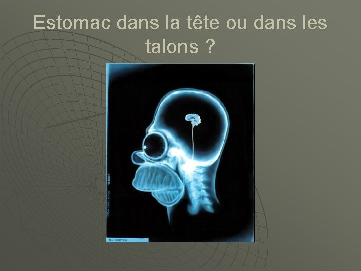 Estomac dans la tête ou dans les talons ? 