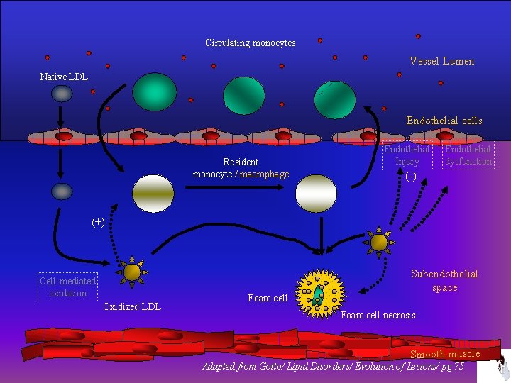 Circulating monocytes Vessel Lumen Native LDL Endothelial cells Resident monocyte / macrophage Endothelial Injury