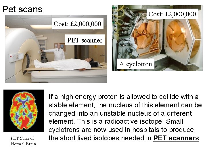 Pet scans Cost: £ 2, 000, 000 PET scanner A cyclotron PET Scan of