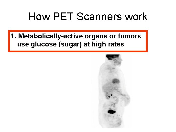 How PET Scanners work 1. Metabolically-active organs or tumors use glucose (sugar) at high
