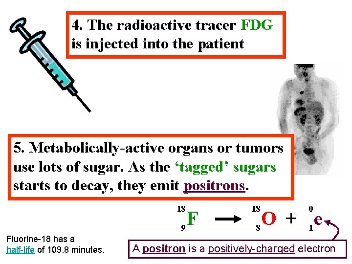 4. The radioactive tracer FDG is injected into the patient 5. Metabolically-active organs or