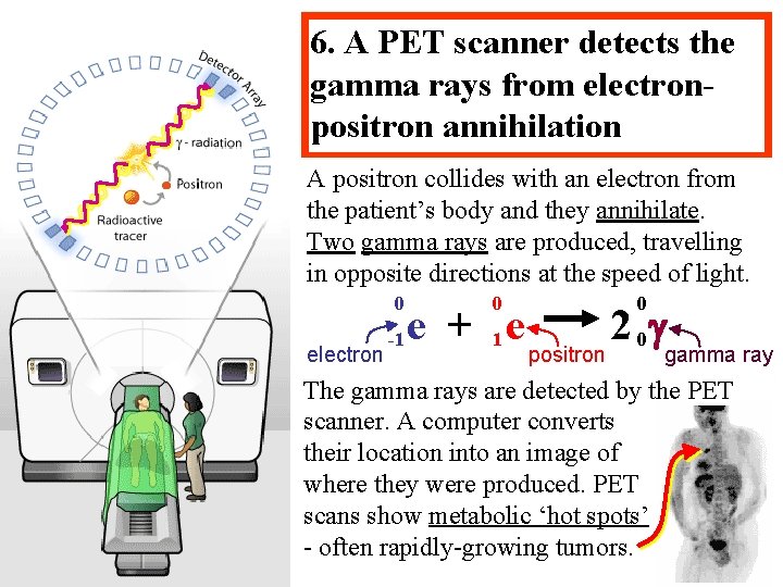 6. A PET scanner detects the gamma rays from electronpositron annihilation A positron collides