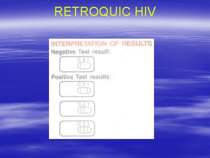 RETROQUIC HIV 