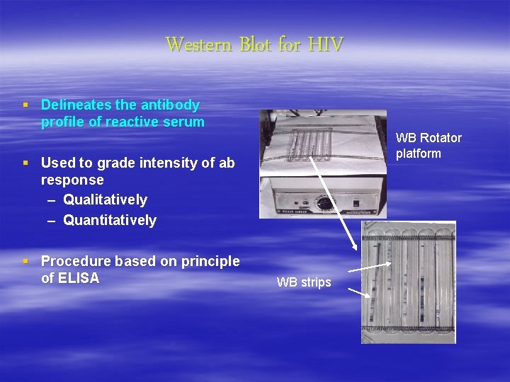 Western Blot for HIV § Delineates the antibody profile of reactive serum WB Rotator