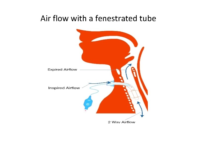 Air flow with a fenestrated tube 