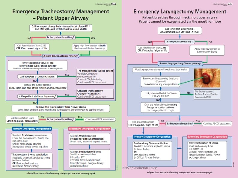 Presentation title / St George’s University Hospitals NHS Foundation Trust 