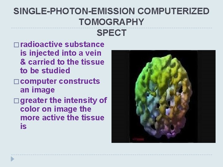 SINGLE-PHOTON-EMISSION COMPUTERIZED TOMOGRAPHY SPECT � radioactive substance is injected into a vein & carried