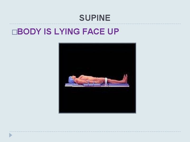 SUPINE �BODY IS LYING FACE UP 