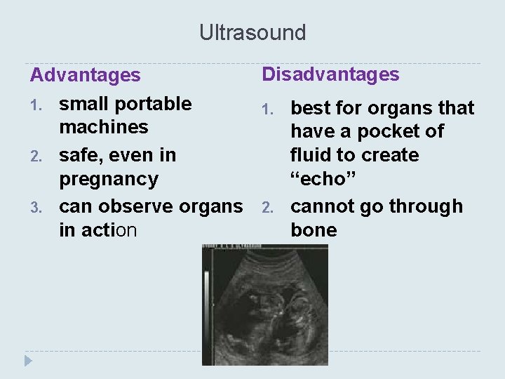 Ultrasound Disadvantages Advantages 1. small portable 1. best for organs that machines have a