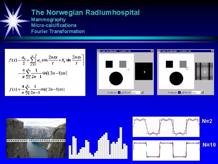 The Norwegian Radiumhospital Mammography Micro-calcifications Fourier Transformation N=2 N=10 
