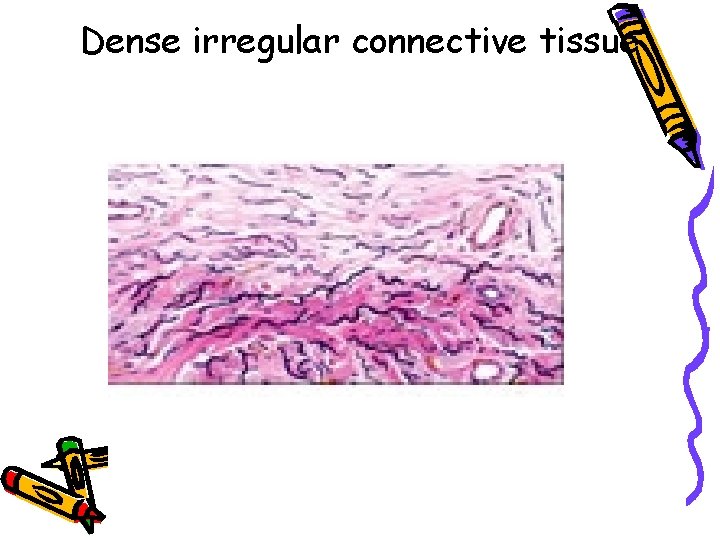 Dense irregular connective tissue 